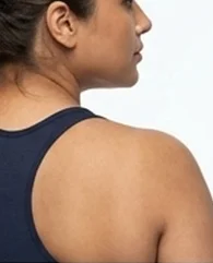 Bra fat and back fat