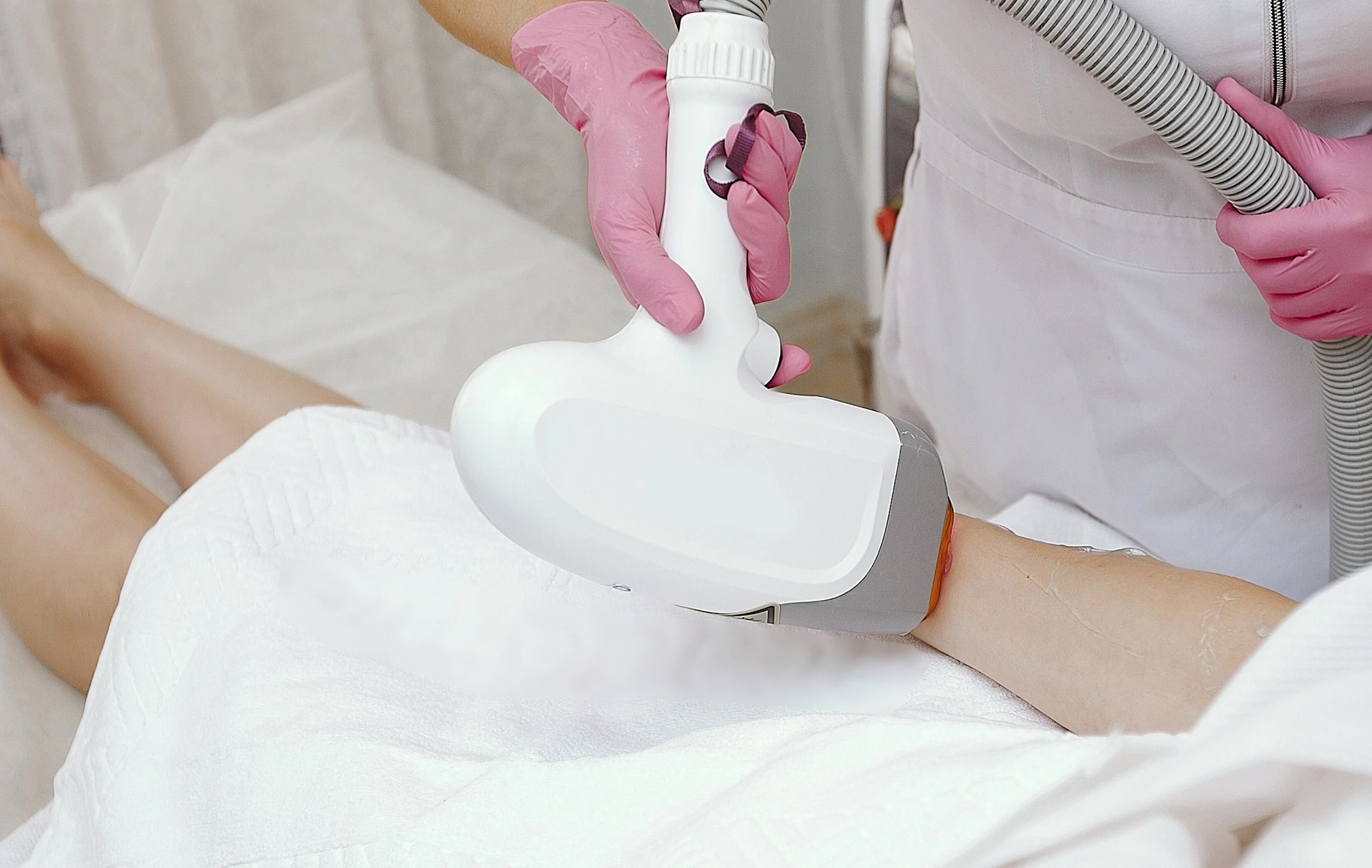 Laser Hair Removal