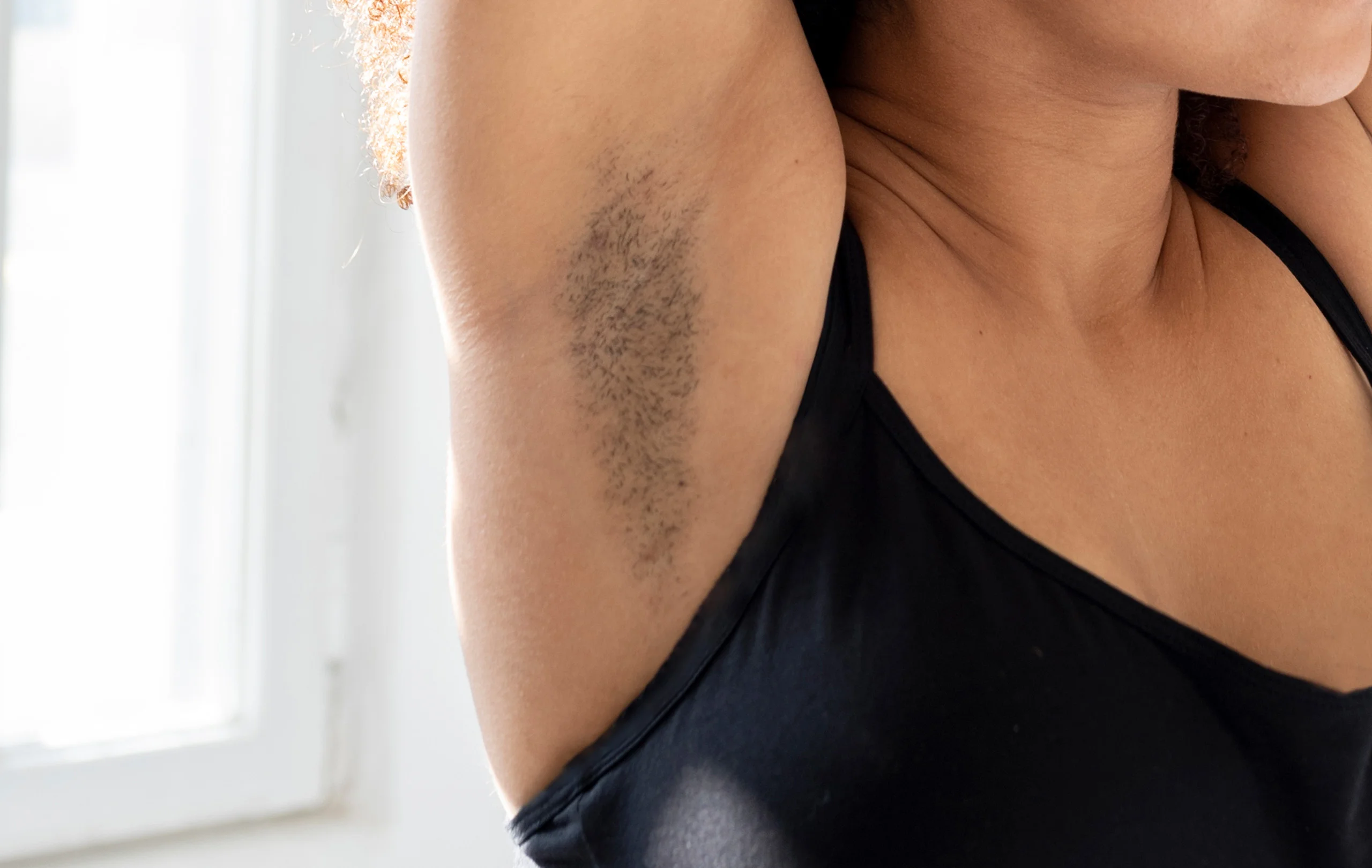 How to Get Rid of Dark Armpits Naturally: Home Remedies, Causes & When to See a Dermatologist